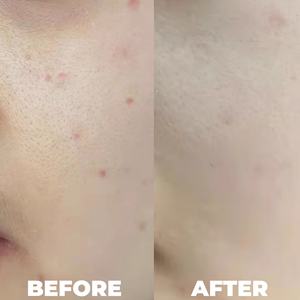 Crema Hidratante Reparadora de Barrera Facial EGF de Fábrica OEM, Alivio Calmante para la Piel Dañada, Reparación de Cicatrices, Gel Calmante con EGF - Product Image 4