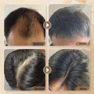 Bulk for Private Label Best Organic <strong>Neo</strong> <strong>Hair</strong> Growth <strong>Oil</strong> - Product Image 5