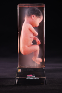 Modèle d'embryon imprimé en 3D d'embryons malformés Apprentissage de l'<span class=keywords><strong>embryologie</strong></span> pour l'éducation médicale - Product Image 4