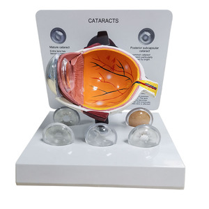 Modelos de Ojos de CIENCIA MÉDICA PARA glaucoma y cataratas - Product Image 4