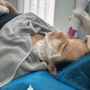Máquina de Rejuvenecimiento de la Piel, Máquina de Estiramiento Facial, Máquina Adelgazante, Precio - Product Image 2