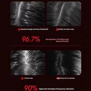 Massaggiatore innovativo del cuoio capelluto con terapia termica per promuovere la vitalità dei capelli massaggiatore - Product Image 4