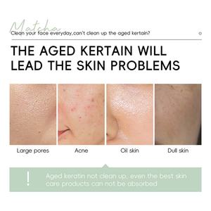 LAIKOU 60g Gel Exfoliante Facial Natural y Orgánico de Matcha para Limpieza Profunda, Marca Privada - Product Image 2