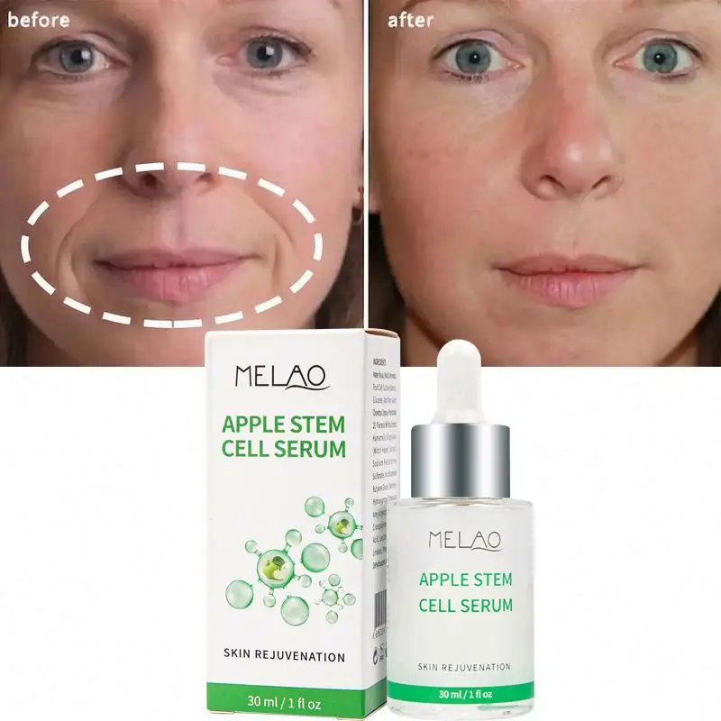100% colágeno Natural antiarrugas Corea para la cara planta humana Apple Stem Cell Skincare Serum OEM Etiqueta Privada
