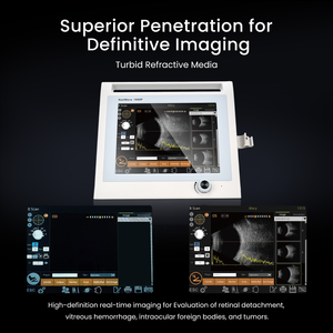 เครื่องอัลตราซาวนด์ตรวจตา A/B Scan Retiwave RW-1000 ของ Aist Optics Ophthalmology จากประเทศจีน สำหรับการตรวจวินิจฉัยโรคตาด้วยระบบ Ab Scan - Product Image 6