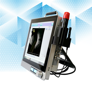 AB <span class=keywords><strong>scan</strong></span> 0.04 mét lâm sàng Độ chính xác chi phí-hiệu quả siêu âm <span class=keywords><strong>scan</strong></span> cho nhãn khoa A/B Scanner - Product Image 2