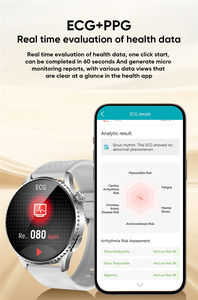 Reloj Inteligente MT800 con Monitor de Actividad Física, Pantalla AMOLED, Llamadas Bluetooth, Compatible con iOS, Monitor de Frecuencia Cardíaca y Presión Arterial - Product Image 5