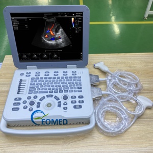 Échographie <span class=keywords><strong>Doppler</strong></span> de couleur d'ultrason humain de vétérinaire fiable idéale pour le diagnostic abdominal et cardiaque CU30-2 d'écho <span class=keywords><strong>Doppler</strong></span> <span class=keywords><strong>portatif</strong></span> - Product Image 4