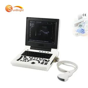 cheapest abdominal laptop clear images medical human obstetrics Gynecology OB ultrasound scanner