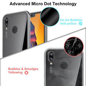 Custodia accessori per telefono cellulare per Huawei <span class=keywords><strong>P20</strong></span> <span class=keywords><strong>Lite</strong></span> 360 Full Body <span class=keywords><strong>Cover</strong></span> per cellulare per Huawei - Product Image 4