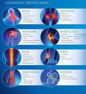 Kelas 4 980nm 1470nm dioda terapi <span class=keywords><strong>Laser</strong></span> fisioterapi punggung rendah penghilang nyeri tulang bahu penyembuhan mesin ortopedi - Product Image 5