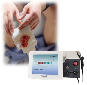 เครื่องทางการแพทย์เส้นใยรูปกรวยแบบมืออาชีพสำหรับการผ่าตัดริดสีดวงทวาร980nm-1470nm รักษาทวารด้วยเลเซอร์สำหรับการผ่าตัดริดสีดวงทวาร - Product Image 6