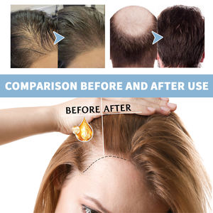 Champú Espumoso Densificante EELHOE, Limpia el Cuero Cabelludo, Nutre el Cabello Grueso, Fortalece el Cabello, Aporta Volumen y Suavidad - Product Image 4