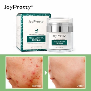 Crema all'ingrosso per cicatrici da acne, formula personalizzata, crema anti-acne per uomo e donna, leggera, delicata, controllo dell'olio, crema per acne infiammata - Product Image 2