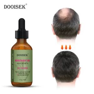Hot Products Herbal Extracts And Essences Organic Hair Rosemary Castor Oils Serum for Hair Growth Fast Effective Hair Growth Oil