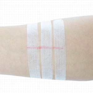 Pansement adhésif Steri-Strip sans couture, pansement à fermeture par traction, pansement chirurgical post-partum. - Product Image 4