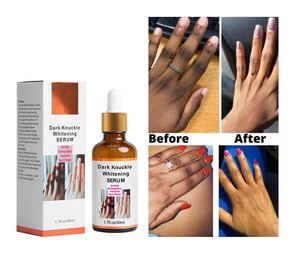 Suero Aclarante Rápido para Manos, Codos y Rodillas, Corrector de Pigmentación para Piel Oscura, Eliminador de Manchas Intensas - Product Image 2