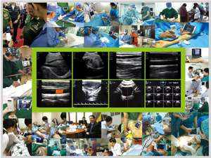 B26G 192 Elements 3 en 1 Máquina de ultrasonido portátil Escáner de ultrasonido de mano para uso humano Escáner de ultrasonido de sonda inalámbrica - Product Image 6