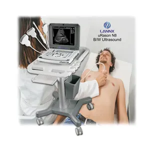 LANNX uRason N8 Notebook sistem ultrasound, mesin USB B/W portabel perangkat diagnostik ultrasonik Harga murah hitam/putih