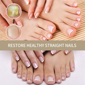 Tratamiento Herbal Antihongos <span class=keywords><strong>para</strong></span> <span class=keywords><strong>Uñas</strong></span> <span class=keywords><strong>de</strong></span> Marca Privada, Suero <span class=keywords><strong>para</strong></span> el Cuidado <span class=keywords><strong>de</strong></span> <span class=keywords><strong>los</strong></span> Pies, Onicomicosis, Paroniquia, Loción <span class=keywords><strong>para</strong></span> <span class=keywords><strong>Hongos</strong></span> en <span class=keywords><strong>las</strong></span> <span class=keywords><strong>Uñas</strong></span> - Product Image 2