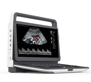 Draagbaar 3d4d Verloskundig Echografiesysteem Met Hartscreening-Volumetrische Imagin Voor Prenatale Diagnose Foetale Echocardiografie - Product Image 4