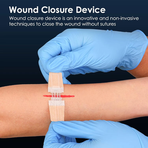 Striscia adesiva per la chiusura della pelle con ferimento chirurgico per la cura della pelle medica trasparente con chiusura a cerniera - Product Image 5