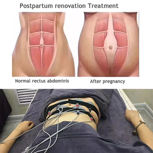 Estimulador Muscular Abdominal Portátil <span class=keywords><strong>Compex</strong></span> Electro Tens con 20 Electrodos - Product Image 5