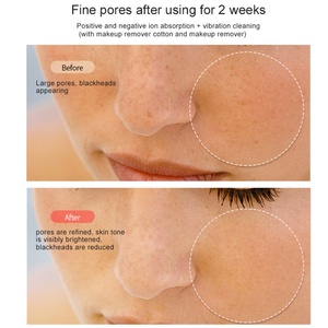 Máquina de Cuidado Facial de Alta Frecuencia USB, Masajeador Facial Reafirmante, Eliminador de Arrugas, Dispositivo de Belleza para el Cuidado del Acné en los Ojos - Product Image 6