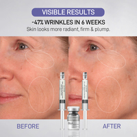 Sérum Ampoule Coréen PDRN Exosome pour Soin de la Peau à Domicile – Kit de Microneedling Lyophilisé Raffermissant, Hydratant et Anti-Rides pour le Visage