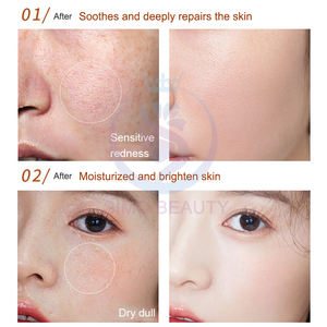 Aloe Vera Solution de rajeunissement Eczéma Récupération Soutien <span class=keywords><strong>Peluche</strong></span> Peau Confort Collagène Peptide Ampoule Pré-Maquillage Rajeunissant - Product Image 4