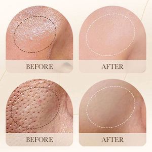 Mousse Nettoyante Bio Anti-Acné Hydratante Soin Peau <span class=keywords><strong>Arbre</strong></span> à Thé Aloès Vera Nettoyant Visage Moussant Brosse Nettoyante Faciale - Product Image 6