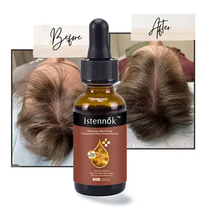 Olio di rosmarino forte effetto cuoio capelluto e rafforzamento dei capelli olio di crescita naturale