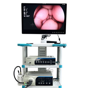 SY-PC047 अच्छी कीमत गैस्ट्रोस्कोपी कोलोनोस्कोपी एंडोस्कोपी कैमरा सिस्टम मेडिकल पोर्टेबल लैप्रोस्कोपी साइटोस्कोप - Product Image 4