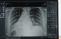 Scanner à rayons X mobile portable, compact et durable, appareil à rayons X portable pour les interventions d'urgence, clinique vétérinaire