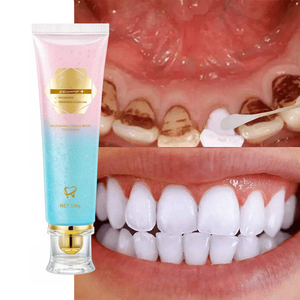 Pasta Dental Blanqueadora Herbal para Adultos 100g, Marca OEM para Eliminar Manchas y Uso Doméstico - Product Image 1