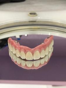 Blocs de céramique dentaires en zircone Disque de zircone Super translucidité 98mm pour système ouvert pour couronne dentaire antérieure et pont - Product Image 6