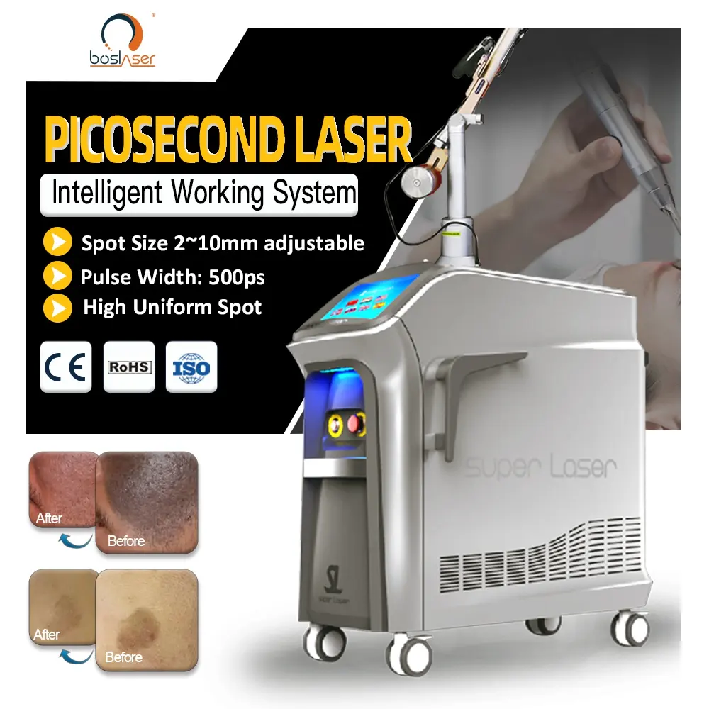 Die meisten profession ellen Pico sekunden Nd Yag Melasma/Chloasma Maschine Schmerzlose Laser Tattoo Entfernung Gerät Pico Laser Korea