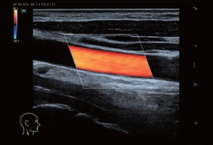 Máquina de Ultrasonido Doppler a Color Digital Portátil Mindray MX5 de Calidad Perfecta para Uso Veterinario con Función Estable - Product Image 3