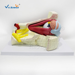 VIC01057 Modèle agrandi de l'œil et des vaisseaux et des nerfs orbitaux, Modèle d'organe structurel humain - Product Image 3