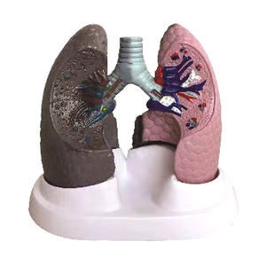 Pabrik langsung sekolah pengajaran manusia model anatomi kronis paru menghalangi Penyakit Paru - Product Image 5