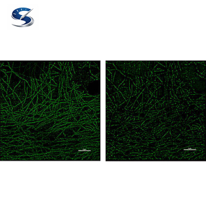 El Sistema de Superresolución N-STORM Ofrece Diez Veces Más Resolución que los Microscopios Ópticos Estándar - Product Image 5