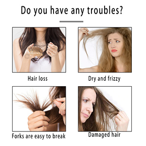 Oem/ODM tự nhiên hữu cơ tăng trưởng tóc chăm sóc thiết lập chống rụng tóc hương thảo dầu gội và điều hòa - Product Image 5