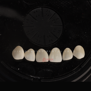 Carilla de cerámica de porcelana para dentaduras postizas de alta calidad, personalización privada para el cuidado <span class=keywords><strong>dental</strong></span>, recuperación oral - Product Image 2