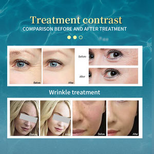 De l'israël <span class=keywords><strong>machine</strong></span> à peler à jet d'eau aqua peeling du visage peeling de la peau oxygène pulvérisateur à jet d'oxygène pour le visage <span class=keywords><strong>machine</strong></span> à peler - Product Image 6