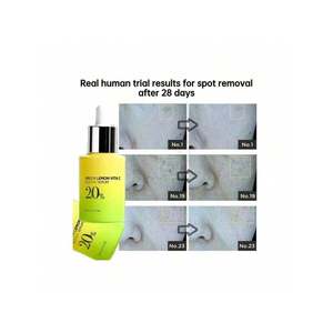 Sérum à la vitamine C Green Lemon Vita C 20% Sérum éclaircissant pour le visage pour tous types de peaux - Product Image 2