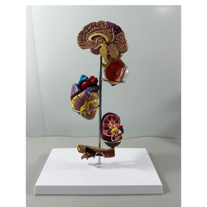 Modelos Anatómicos Médicos de Patología de la Presión Arterial Alta de Maxcare (Cerebro/Ojos/Corazón/Riñones/Vasos Sanguíneos/Organos Internos) de PVC - Product Image 2