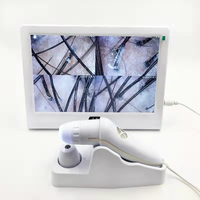 Analyseur de peau et de cheveux avec lentille 50x et lentille 200x, scanner cutané pour usage en salon