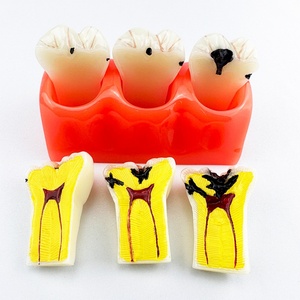 FUREIN SMILE Modelo Dental Patológico Desmontable 4 en 1, Anatomía del Diente con Caries, Educación Dental, Higiene Bucal Multiusos, PVC - Product Image 2