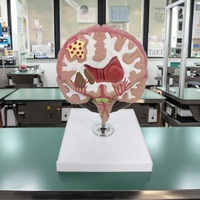 Modèle médical de pathologies cérébrales, modèle anatomique de maladies du cerveau pour l'enseignement médical, affichage des structures pathologiques, CE ROHS ISO