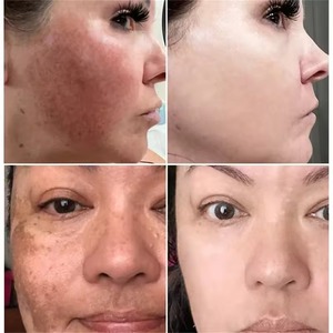 Crema Coreana Blanqueadora Antioxidante e Hidratante para Rostro y Cuerpo con Glutatión y Vitamina C, Libre de Crueldad Animal - Product Image 2